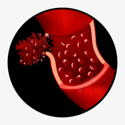 脑出血医疗红色细胞壁矢量图高清图片