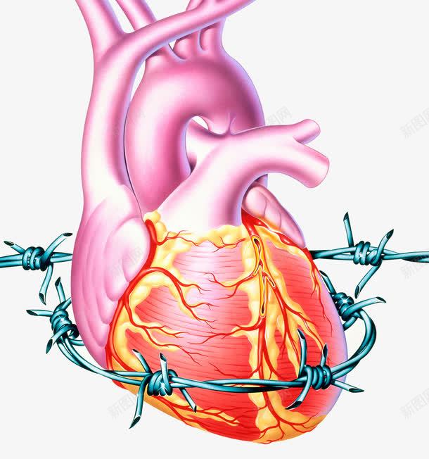 胆固醇冠心病png免抠素材_新图网 https://ixintu.com 冠心病 心脏疾病 胆固醇 血管