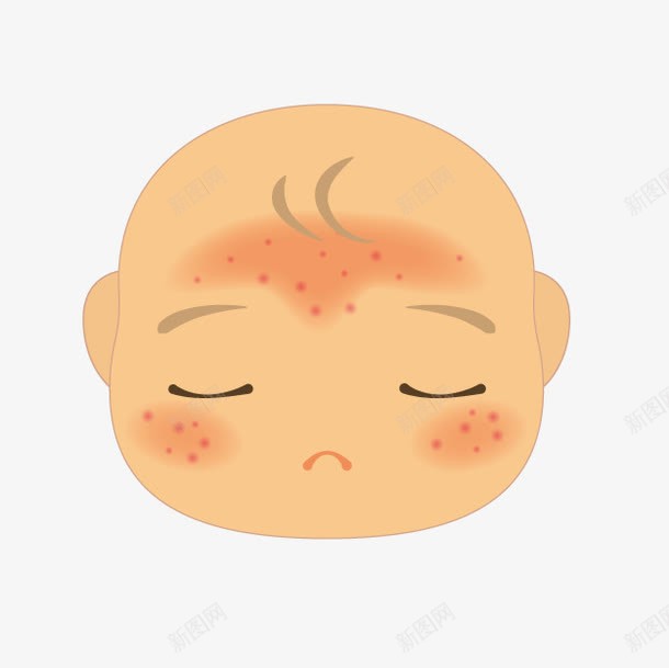 卡通婴儿湿疹png免抠素材_新图网 https://ixintu.com 医院图示 卡通湿疹 婴儿湿疹 皮肤问题