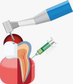 拔牙工具补牙图标矢量图高清图片
