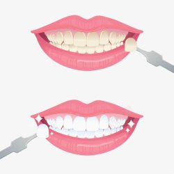 专业护牙手绘牙齿美白高清图片