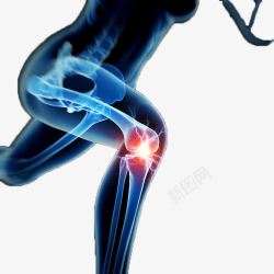 膝关节疼痛素材