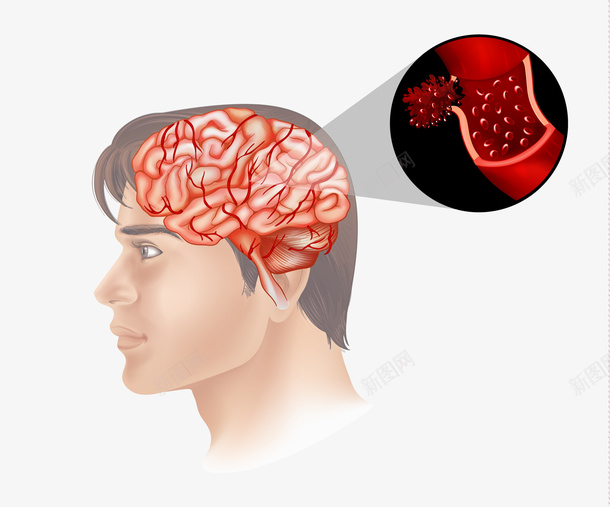 人体大脑矢量图eps免抠素材_新图网 https://ixintu.com PNG免抠图下载 医学 男性 脑子 血管 装饰 矢量图