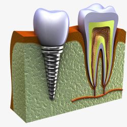 泌尿系统解剖图牙痛修复解剖图高清图片