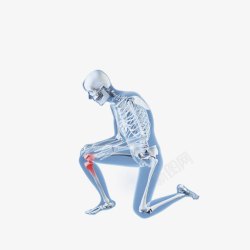 腰腿肩颈肘疼痛卡通腿部关节疼X光人体图高清图片