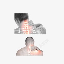 颈椎模拟图颈椎疼的男女实物图高清图片