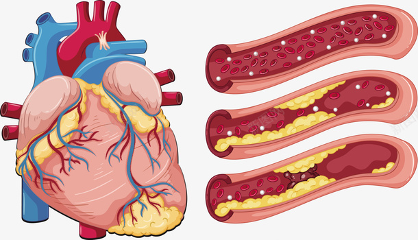 心脏血管矢量图eps免抠素材_新图网 https://ixintu.com 人体心脏 心脏 心脏图案 心脏血管 矢量图 血管PNG 血管心脏