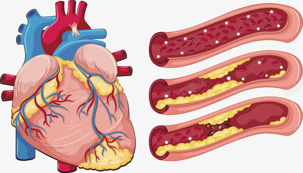 心脏血管矢量图png图片免费下载 素材7nxukqeka 新图网