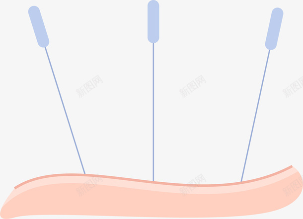 皮肤卡通针灸png免抠素材_新图网 https://ixintu.com 中医 中国针灸 卡通针灸 皮肤 矢量针灸 针灸 针灸疗法