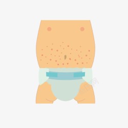 婴儿湿疹卡通婴儿腹部湿疹高清图片