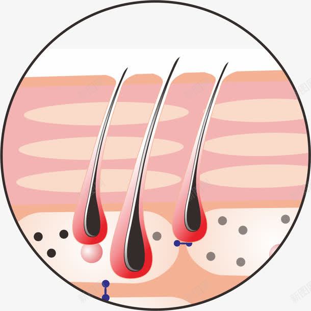 皮肤粉刺png免抠素材_新图网 https://ixintu.com 皮肤结构 皮肤表皮 粉刺 细胞 结构图 面部皮肤结构