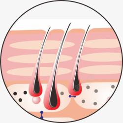 皮肤层细胞结构皮肤粉刺高清图片