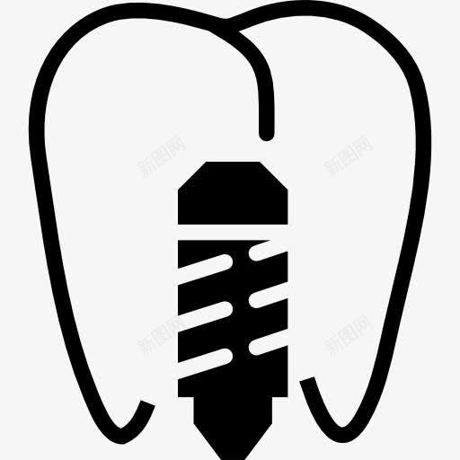植入图标png_新图网 https://ixintu.com 医疗 嘴 牙医 牙科 牙齿 磨牙 种植体