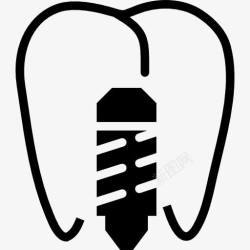 牙齿种植体植入图标高清图片