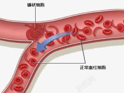 血红细胞示意图素材