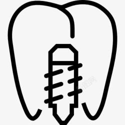 牙齿种植体植入图标高清图片