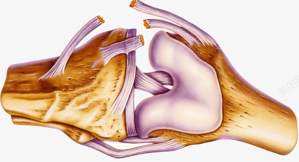 半月板撕裂psd免抠素材_新图网 https://ixintu.com 医疗插图 扭伤 撕裂 韧带