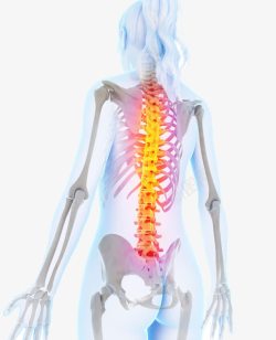 腰椎问题人体骨骼医疗高清图片