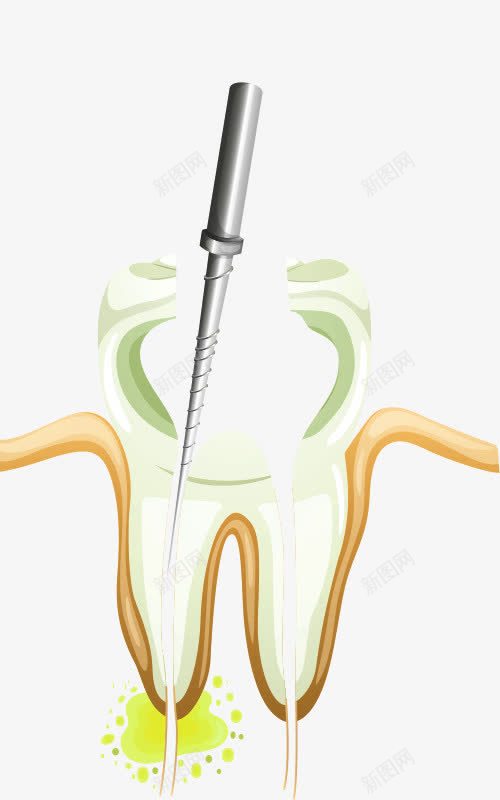 牙痛治疗卡通图png免抠素材_新图网 https://ixintu.com 牙医医生 牙痛 牙齿治疗 牙齿疼痛