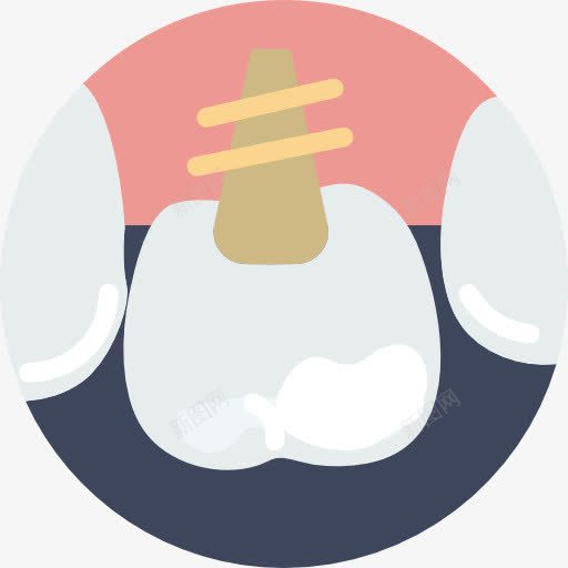 植入图标png_新图网 https://ixintu.com 医疗 嘴 牙医 牙科 牙齿 磨牙 种植体