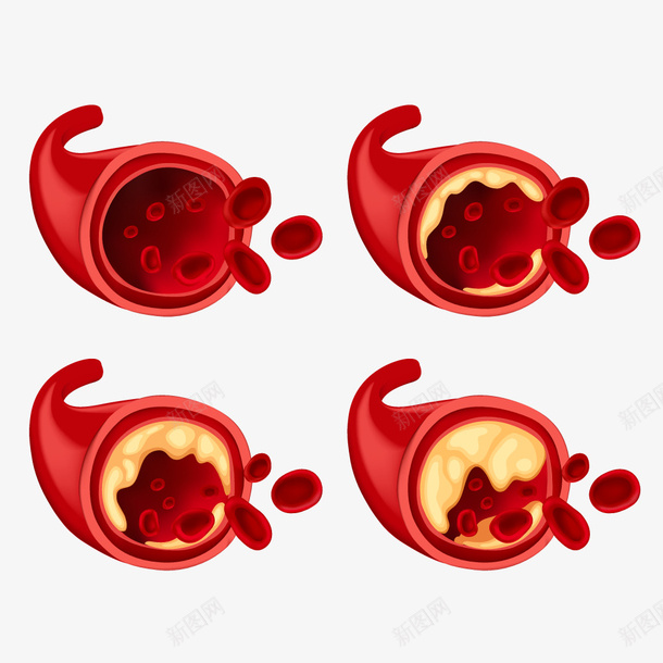 医疗细胞体png免抠素材_新图网 https://ixintu.com 医学 医疗 矢量细胞体 红细胞 红细胞血液插图 红色 细胞壁