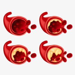 红色细胞医疗细胞体高清图片