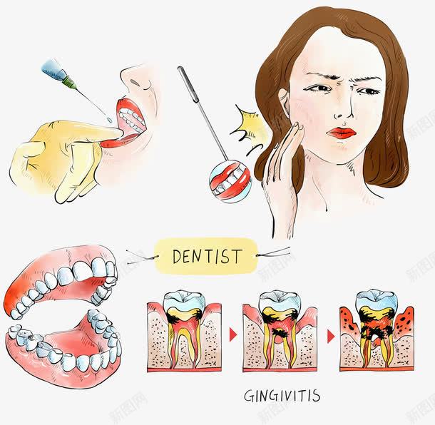 牙医手术医疗插图png免抠素材_新图网 https://ixintu.com 医疗插图 口腔卫生 注射 牙根 牙疼