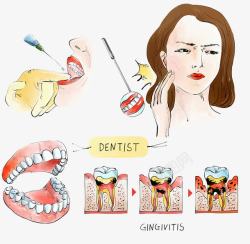 牙根牙医手术医疗插图高清图片