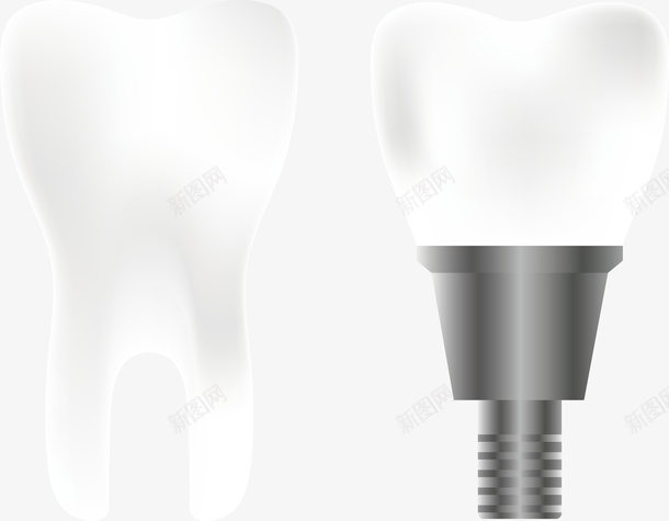正常的牙齿和种植的牙齿矢量图eps免抠素材_新图网 https://ixintu.com 牙齿 牙齿png 牙齿矢量图 白牙 白色 矢量图