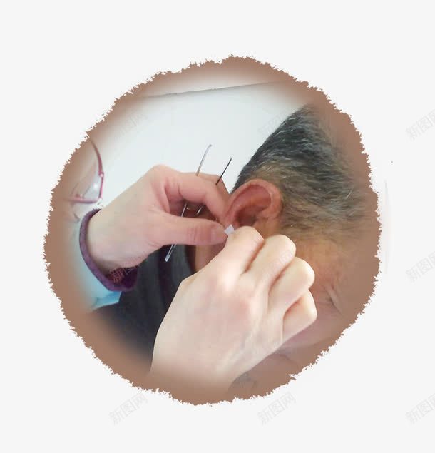 中医贴耳穴png免抠素材_新图网 https://ixintu.com 中医 人体 人体穴位 人耳朵 治疗 耳朵 贴耳穴