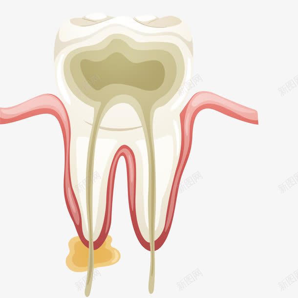 艺术救治牙齿png免抠素材_新图网 https://ixintu.com 医学观察 治疗 科学研究 虫牙齿 蛀牙