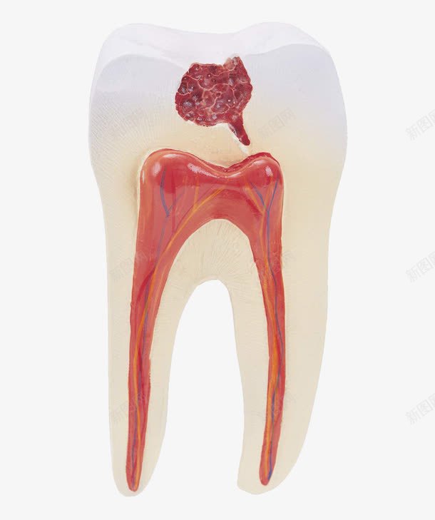 牙齿蛀牙png免抠素材_新图网 https://ixintu.com 口腔 口腔卫生 牙齿 蛀牙