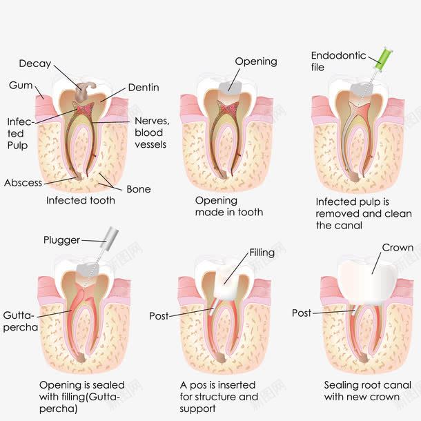 牙齿根部png免抠素材_新图网 https://ixintu.com 医学观察 救治 治疗 观察 齿根