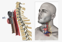 气管外科手术素材