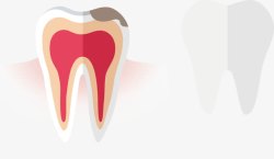 人类牙齿剖面图素材