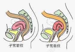 子宫前后位素材