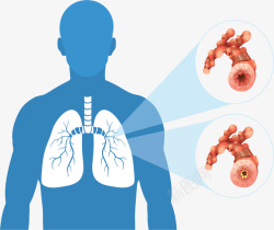 器官构造人体医疗器官疾病矢量图高清图片