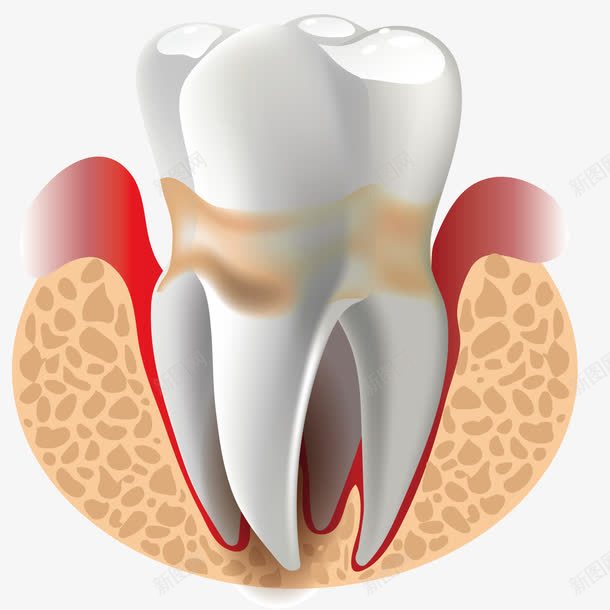 医疗齿根png免抠素材_新图网 https://ixintu.com 医学研究 医学观察 牙医 牙齿