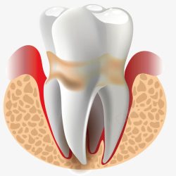 齿根医疗齿根高清图片