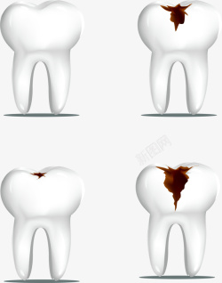 臼齿3D臼齿过程图矢量图高清图片