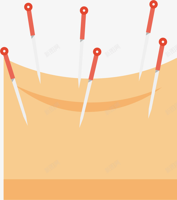 背部弧形针灸png免抠素材_新图网 https://ixintu.com 中医 中国针灸 弧形 弧形针灸 矢量针灸 背部 针灸疗法