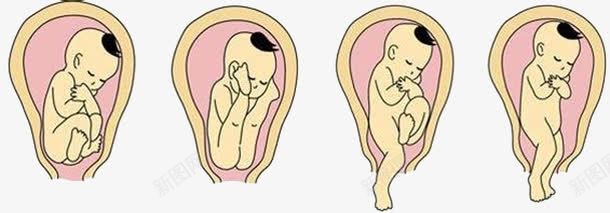 胎儿的出生png免抠素材_新图网 https://ixintu.com 一只脚先生出来 两只脚先生出来 屁股先生出来 立生 顺产