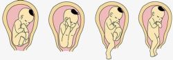 顺产胎儿的出生高清图片