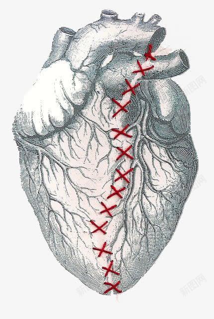 卡通心脏手术png免抠素材_新图网 https://ixintu.com 心脏 心跳 手术 缝合
