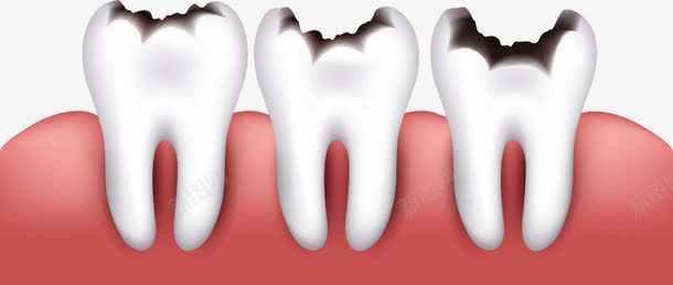 断开的牙齿png免抠素材_新图网 https://ixintu.com 坏牙 断开 牙科 牙齿
