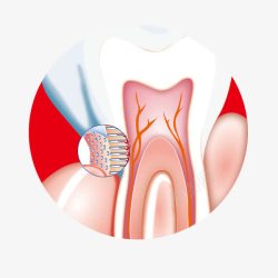 牙科牙齿剖面素材