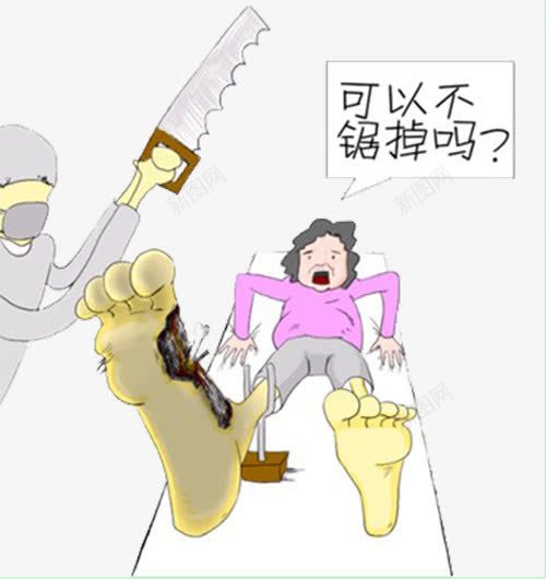 糖尿病足截肢png免抠素材_新图网 https://ixintu.com 截肢 溃烂 糖尿病 糖尿病足 脚底 降血糖