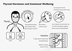 临床医学甲状腺临床医学高清图片