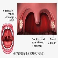 手绘喉咙细节图素材