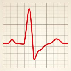 医学图表心电图矢量图高清图片